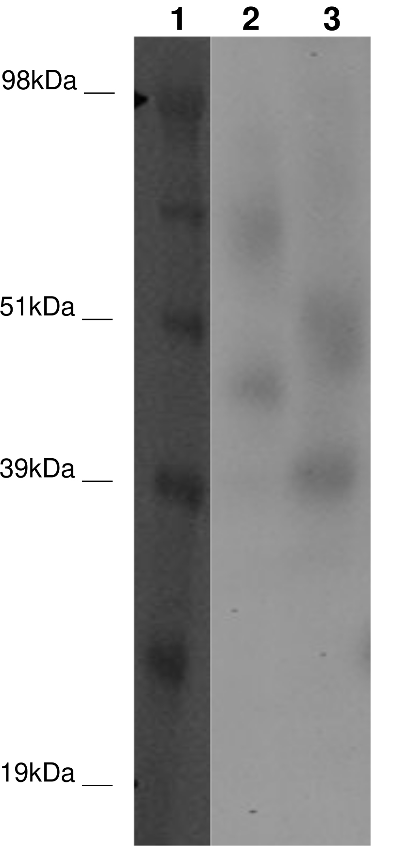 PathHunter® Human GPR30 β-Arrestin Stable Cell Line Assay (CHO-K1)