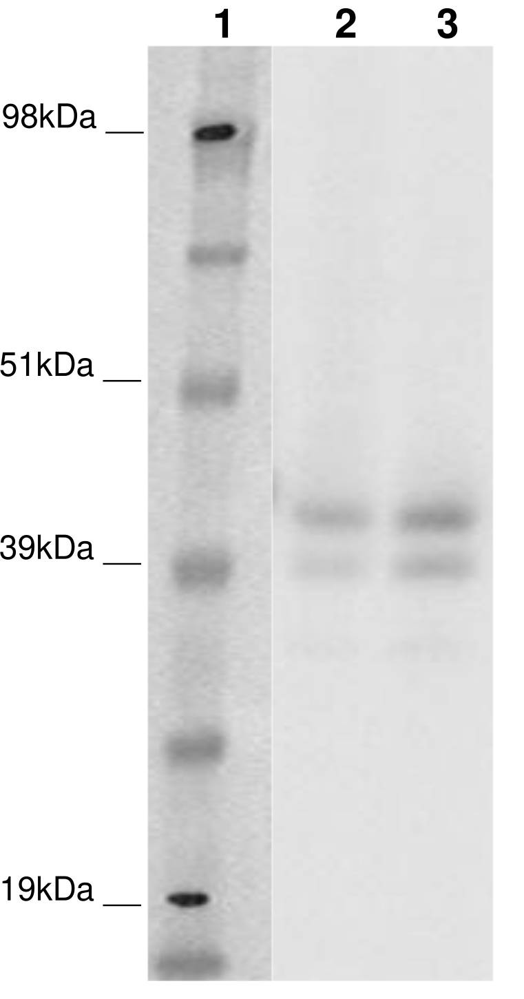 PathHunter® Human GPR142 β-Arrestin Stable Cell Line Assay (CHO-K1)
