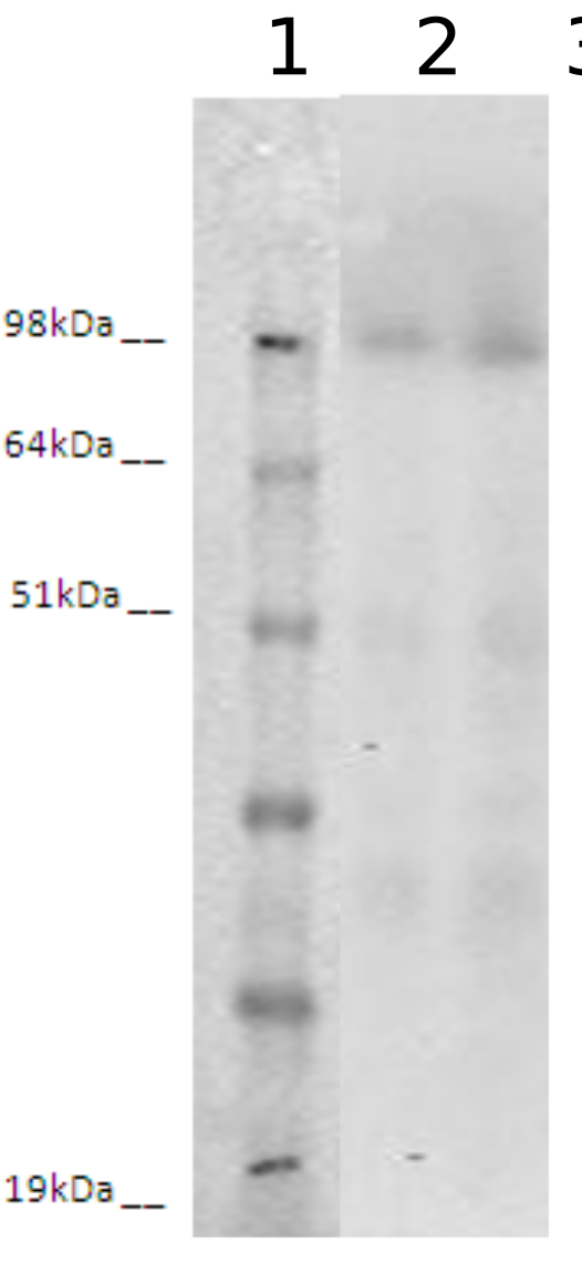 PathHunter® Human LGR6 β-Arrestin Stable Cell Line Assay (CHO-K1)