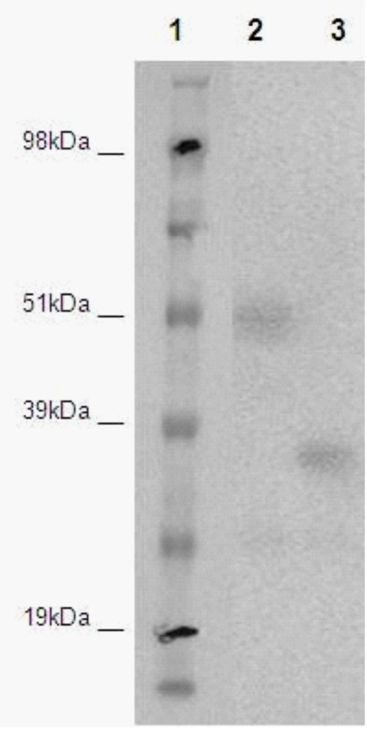 PathHunter® Human DARC β-Arrestin Stable Cell Line Assay (CHO-K1)