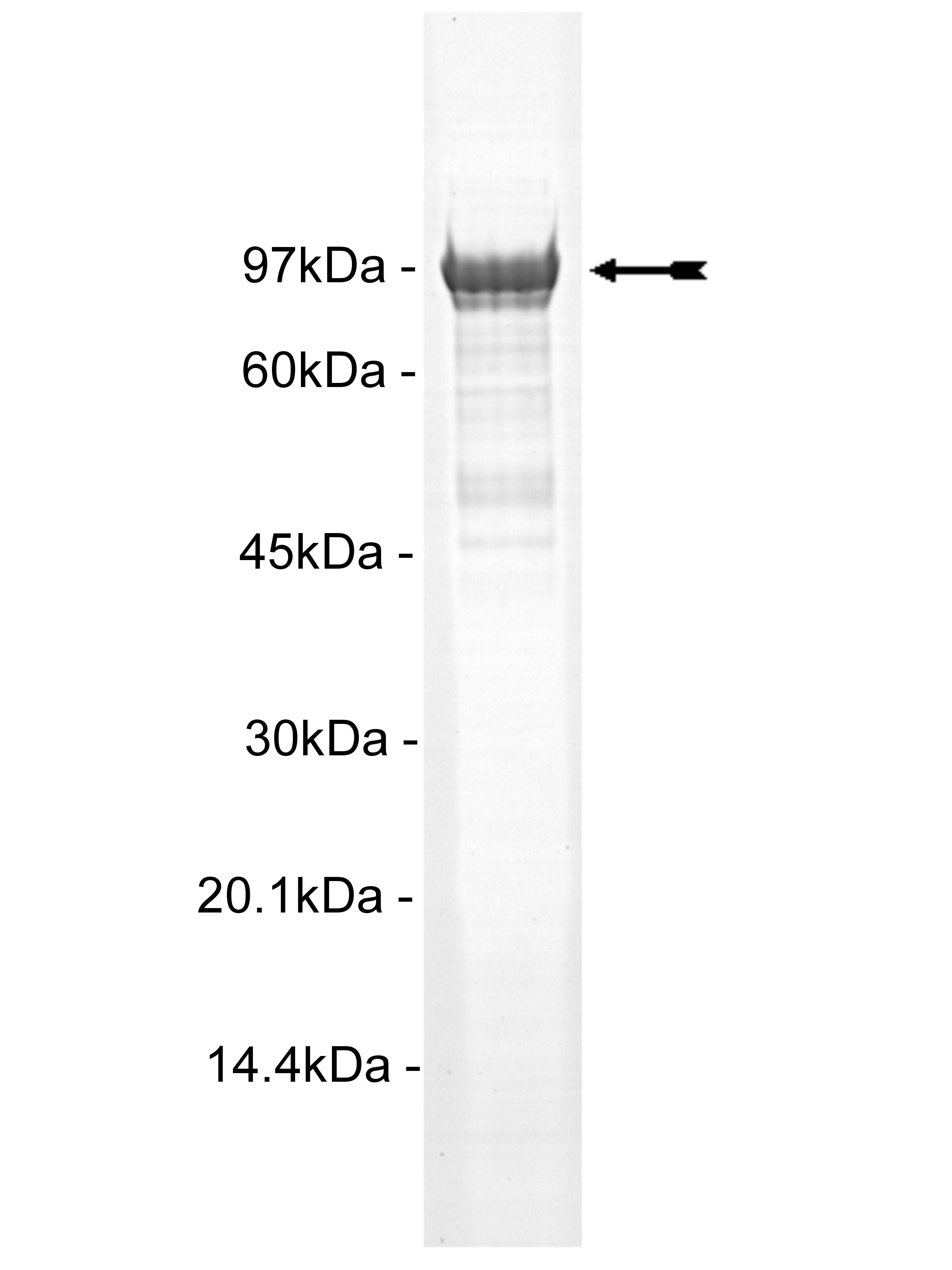 MSK1, active (flag tag)