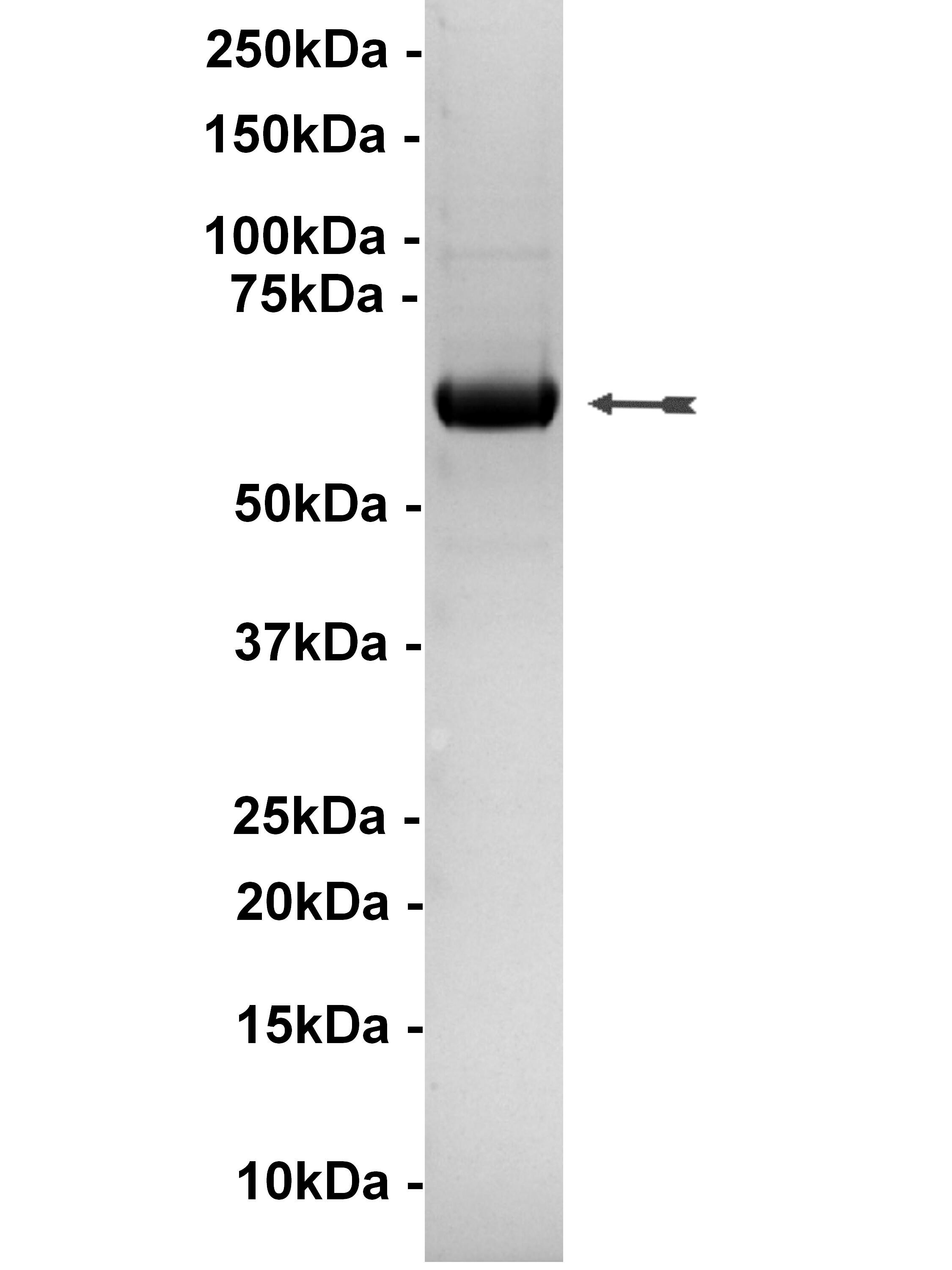 Akt1/PKBalpha, active