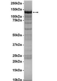 PKD3, active