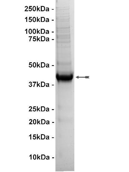 PRP4, active