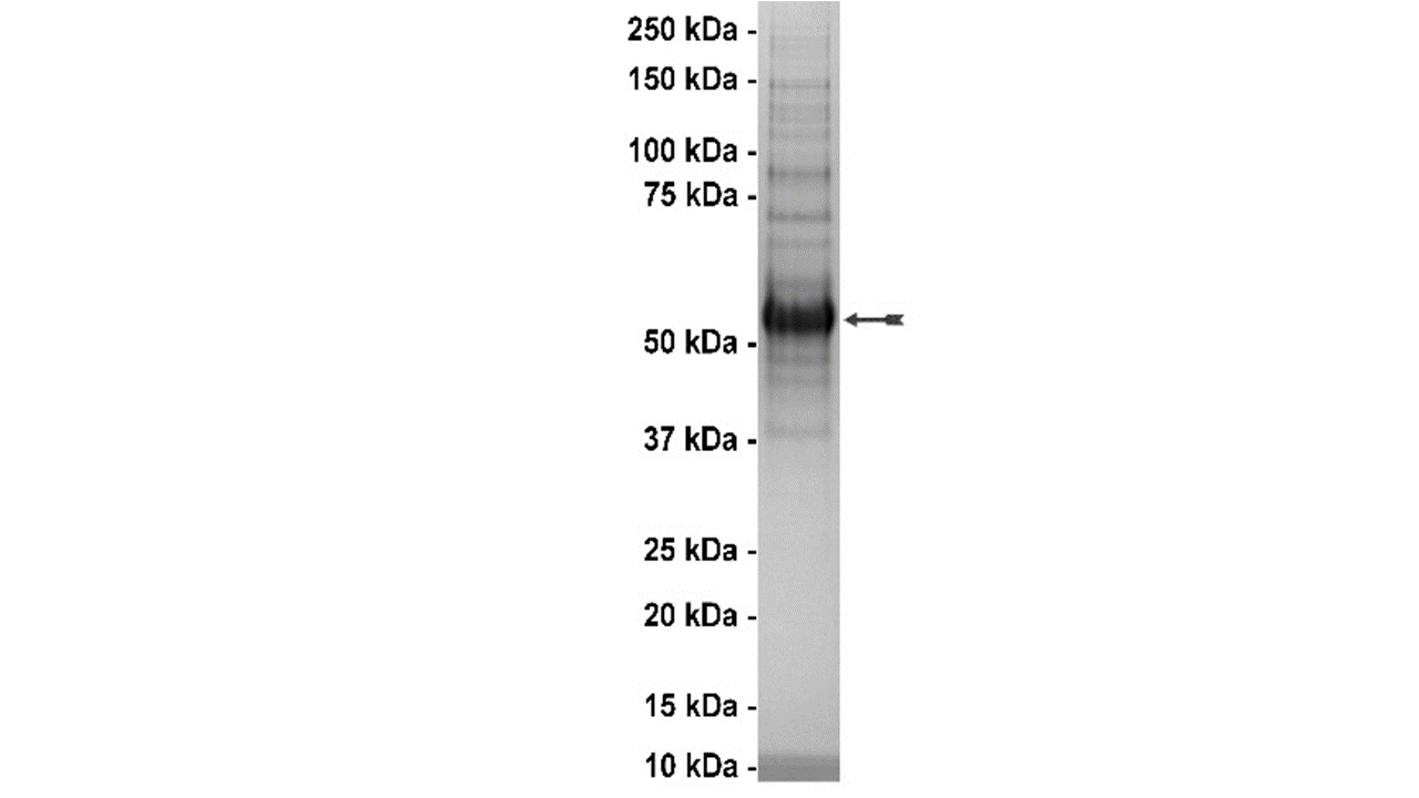 MAST1, active