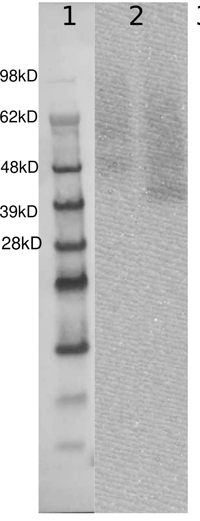 PathHunter® U2OS GPR22 β-Arrestin Orphan GPCR Cell Line