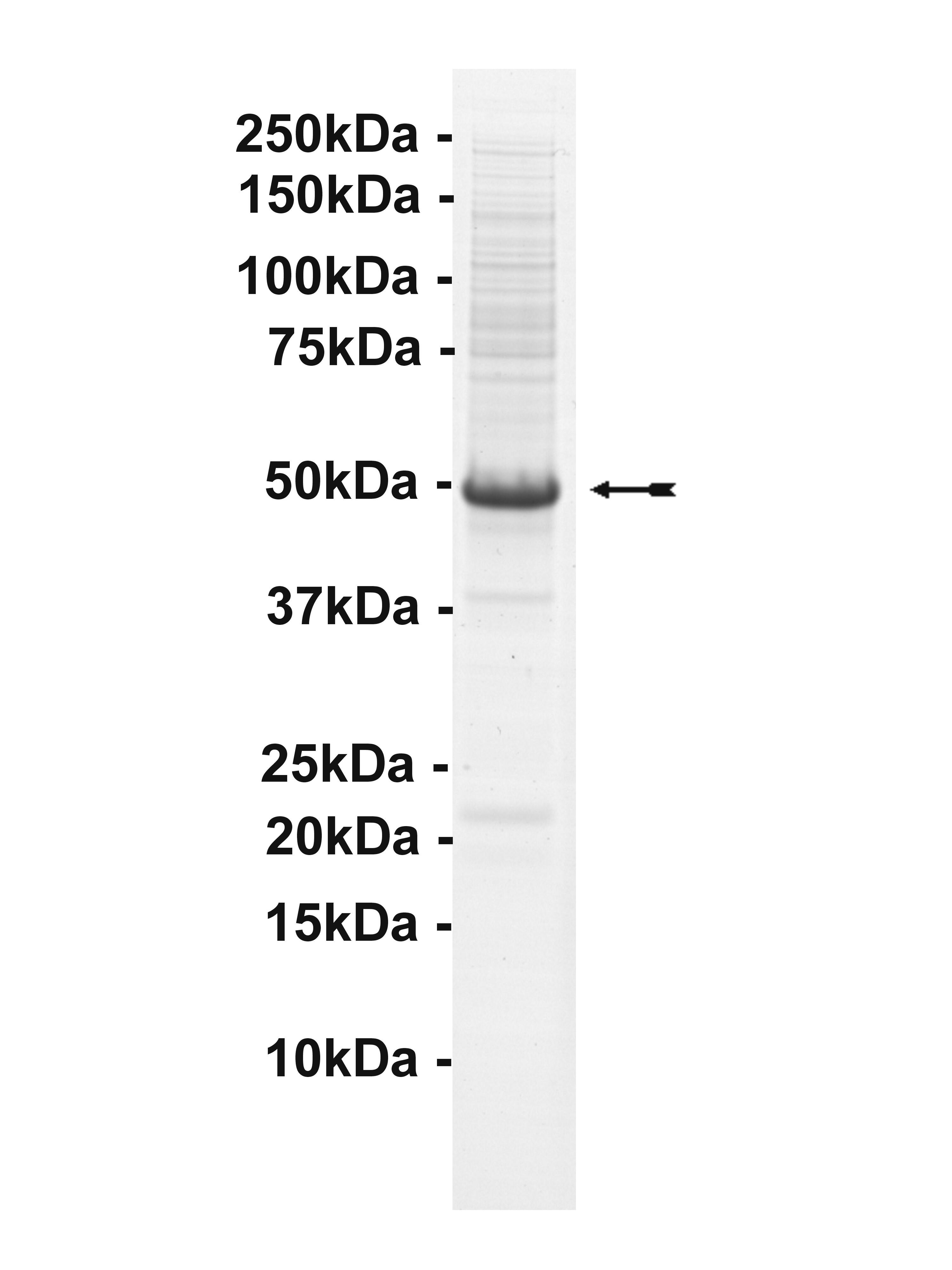 STK32A, active