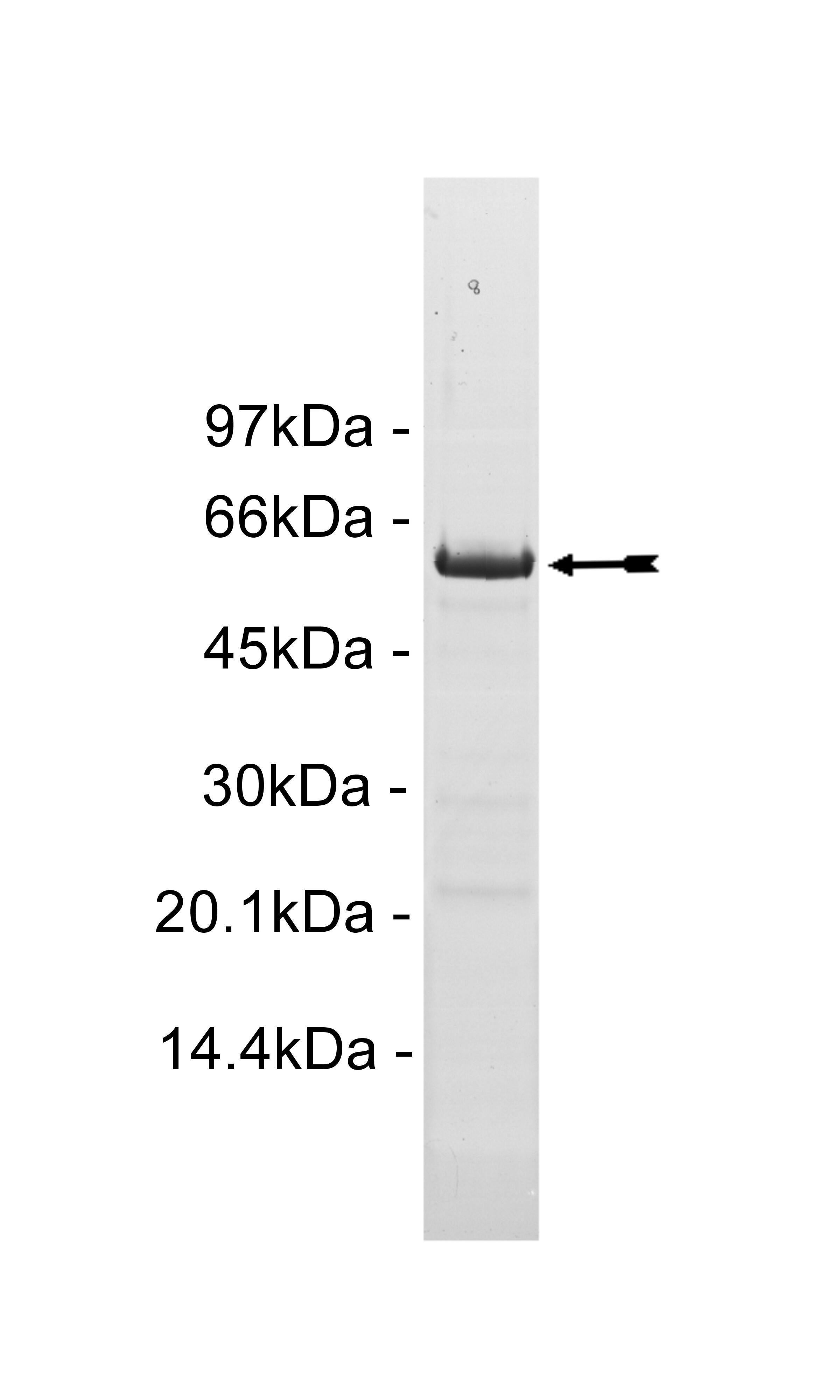 PTPN22, active