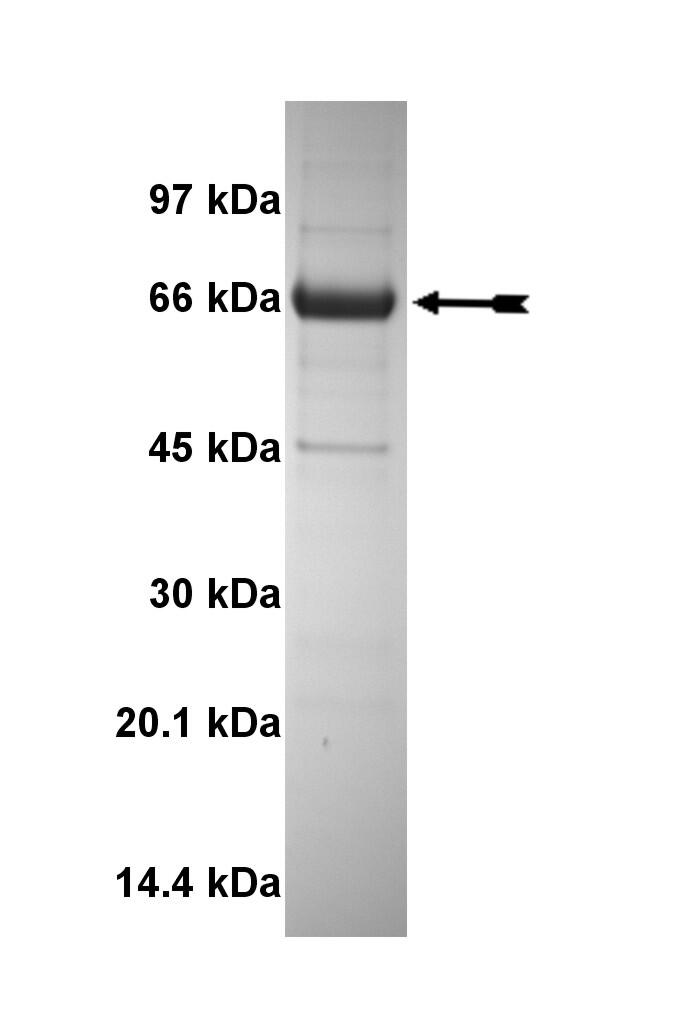 MSSK1, active