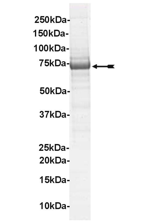 c-Kit (D816V), active