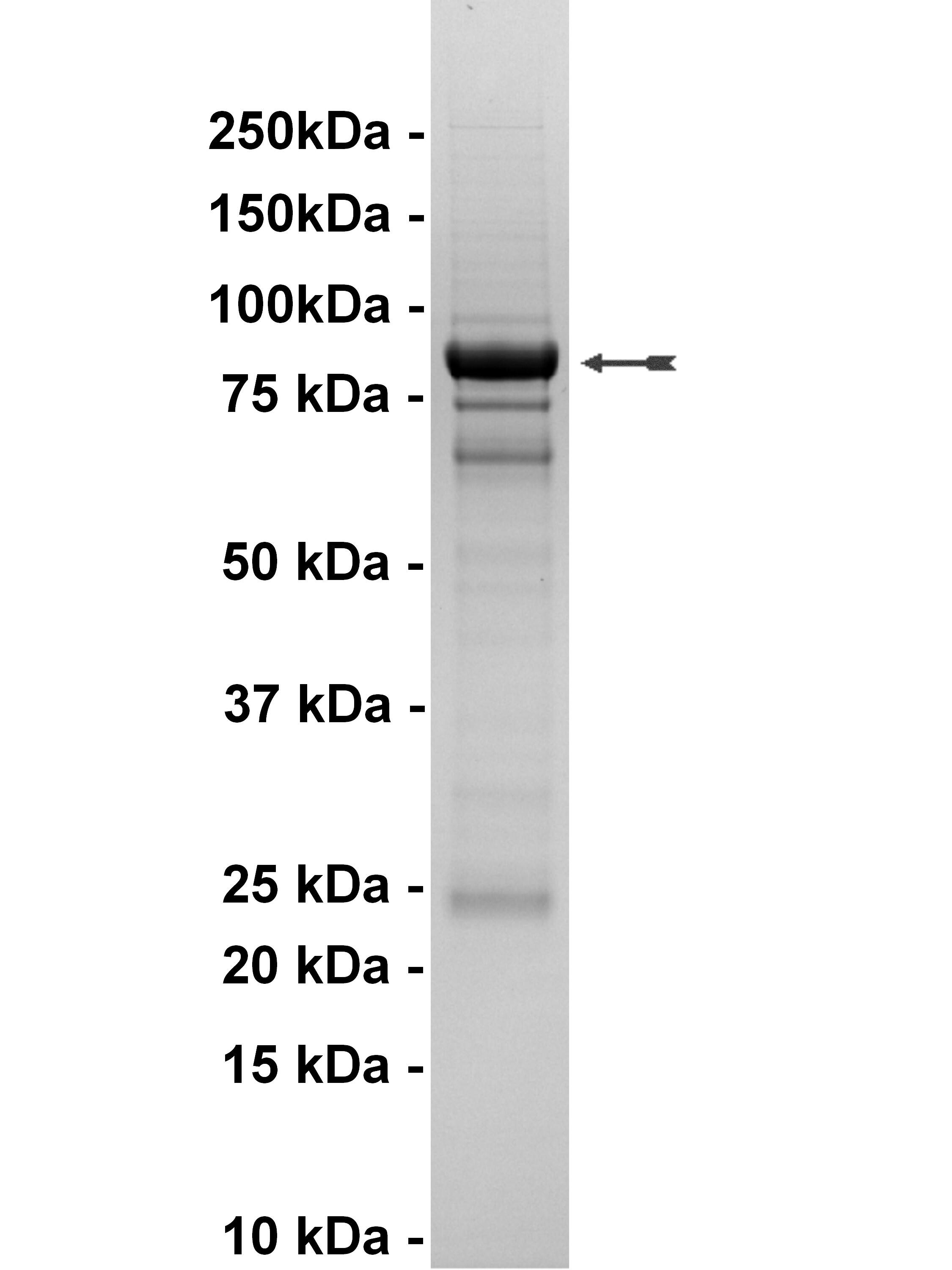 EGFR, active